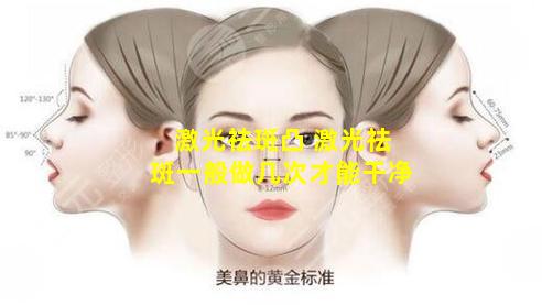 激光祛斑凸 激光祛斑一般做几次才能干净